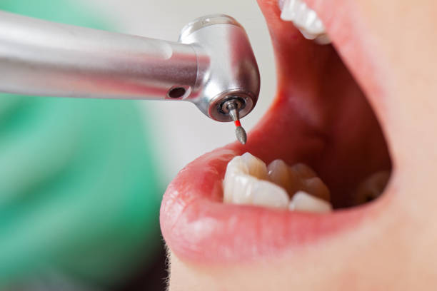 Best Emergency Treatment for Jaw Pain or Injury in James Island, SC